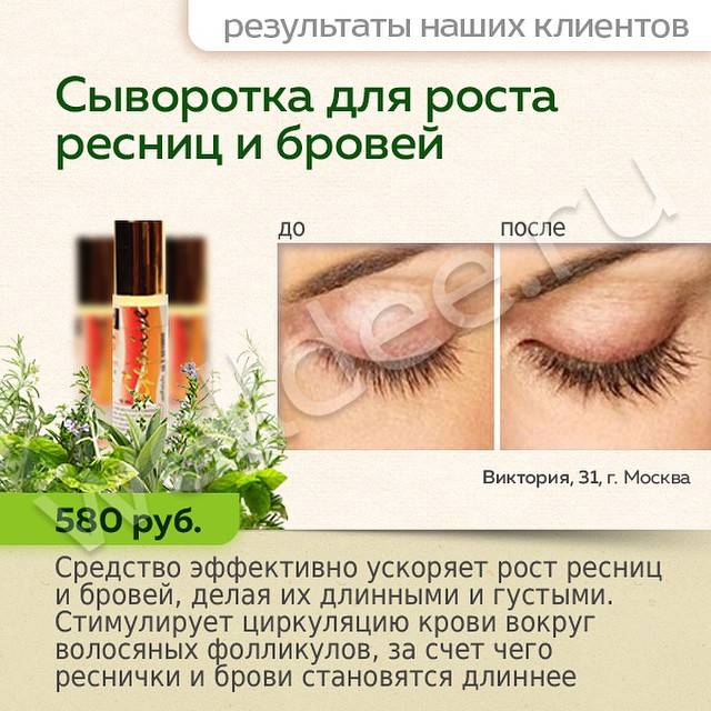 ?как сделать ресницы длинными и густыми в домашних условиях?
