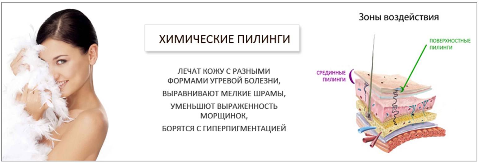 Пилинг для лица, химический пилинг – что это, как выбрать? | клиника "отражение"