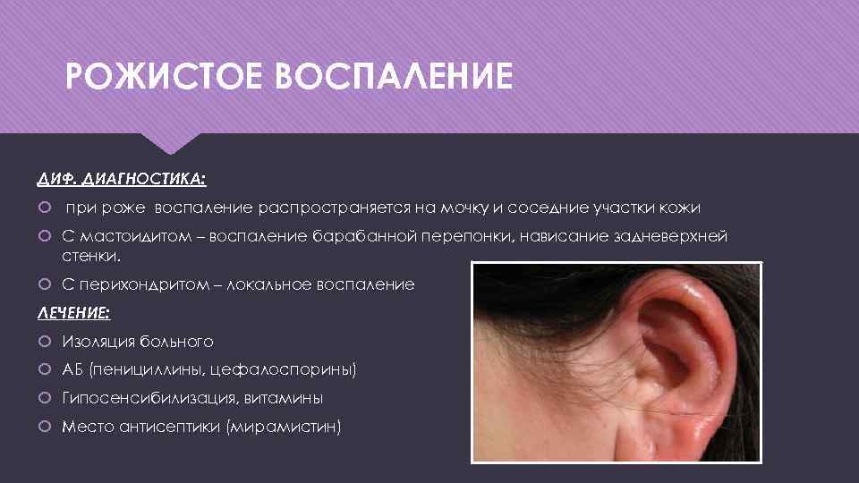 Рожа на ноге