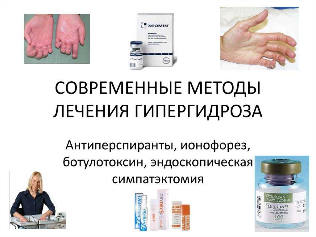 Лечение гипергидроза (повышенного потоотделения). чем лечить и как вылечить? - клиника "отражение"
