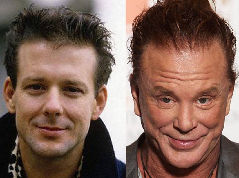 Микки рурк: операции и фото до и после, серьезная пластика 2015 | marykay-4u.ru