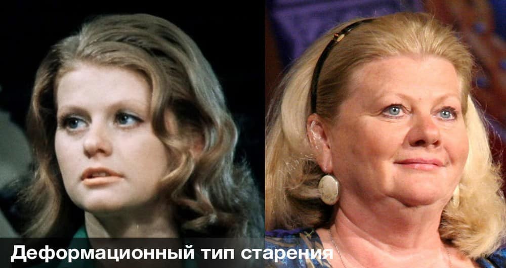 Типы старения кожи и процедуры способные их скорректировать | клиника "отражение"
