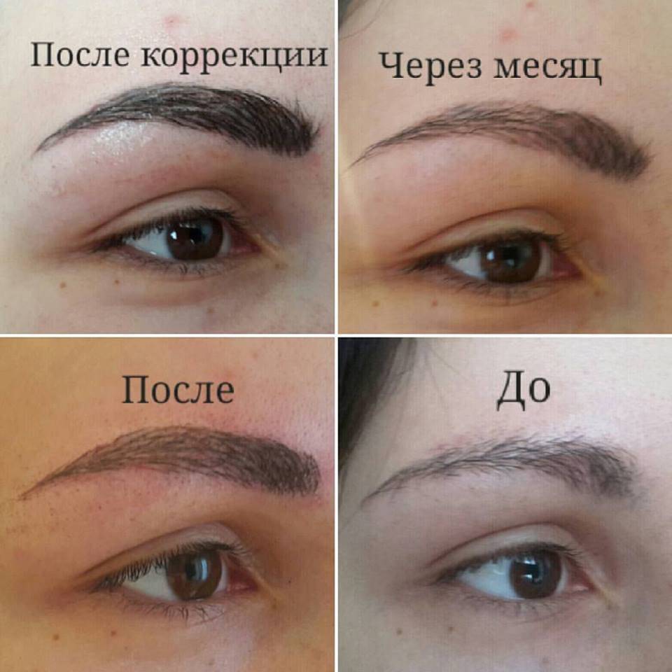 Не растут брови? топ-5 лучших средств