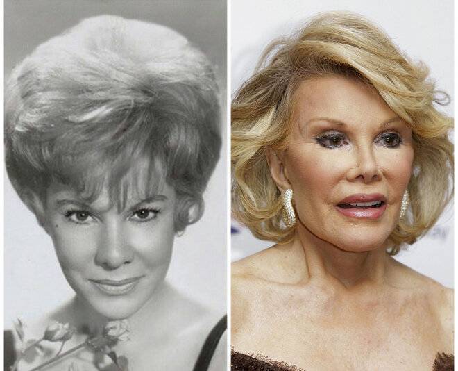 Was joan rivers killed for insulting the obamas?! | tech arp