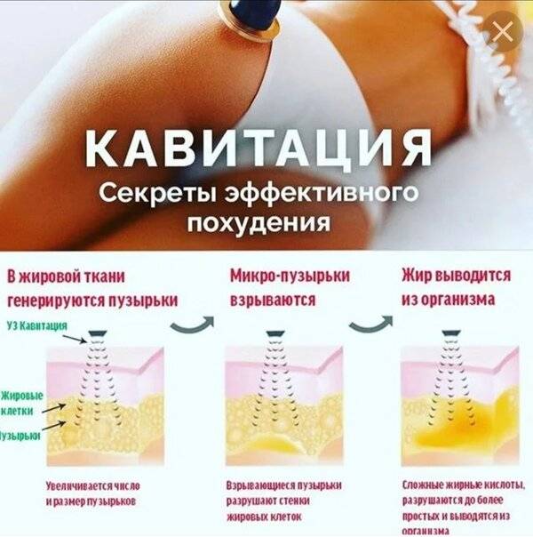 Ультразвуковая кавитация: что такое уз кавитация, описание, отзывы, противопоказания