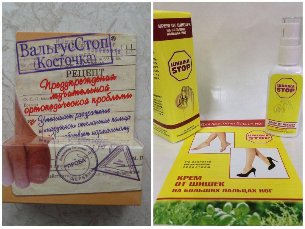 Помогает ли валгус про