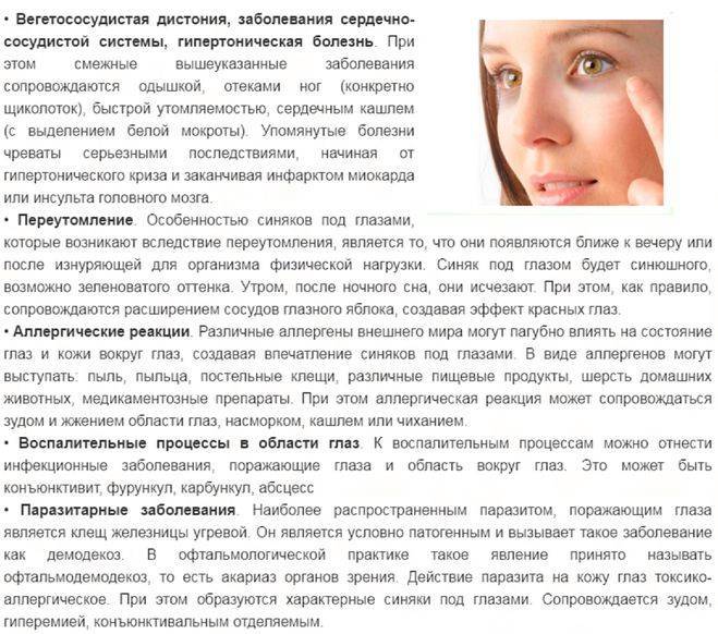 Как убрать синяк под глазом от удара: за 1 день в домашних условиях