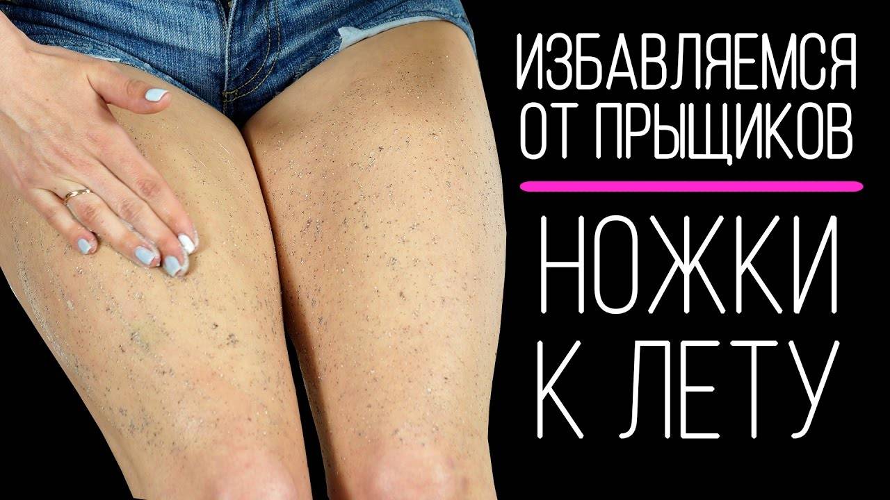Как избавиться от красных прыщей на попе. как убрать следы от прыщей на попе: советы для мужчин
