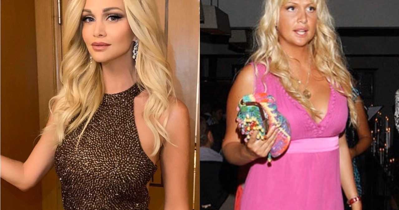 Виктория лопырева до и после пластики