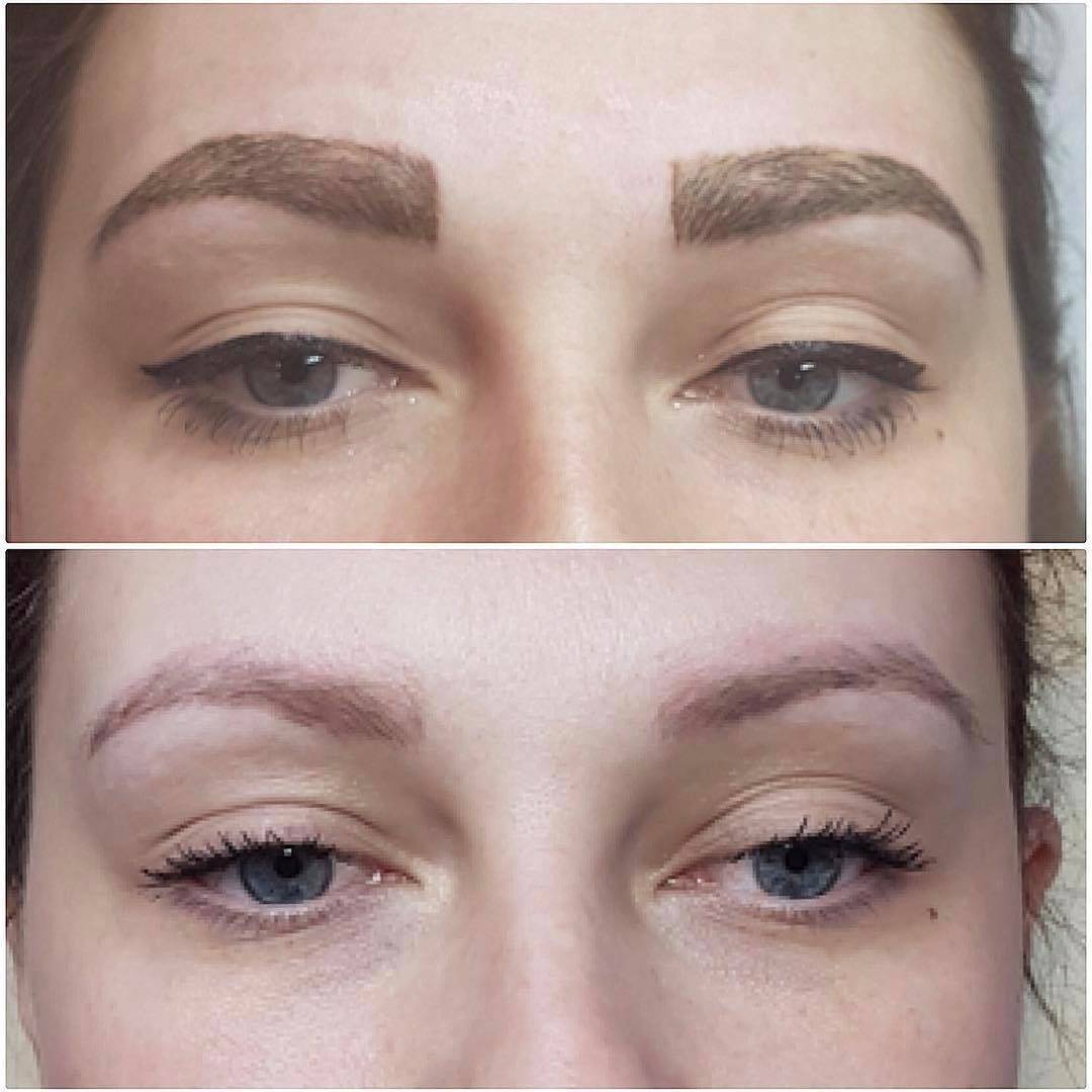 Как удалить татуаж бровей: способы выведения если сделанный татуаж сделан некачественно