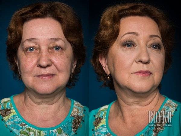 Макияж для нависшего века: причины тяжёлых век, рекомендации визажистов по увеличению глаз, возрастной макияж