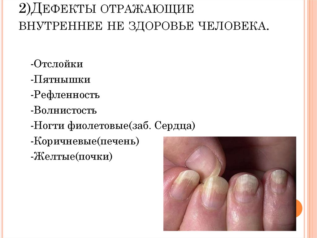Что ногти говорят о состоянии здоровья человека: фото, диагностика проблем по виду ногтей