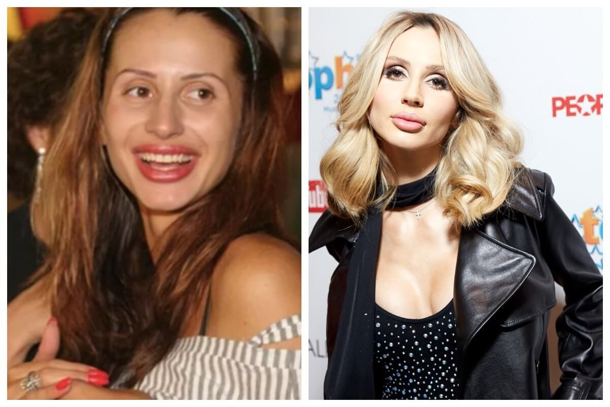 Светлана лобода: фото до и после пластических операций