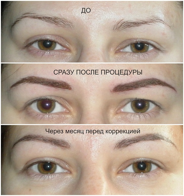Сколько отрастают брови после выщипывания. как отрастить брови после выщипывания.