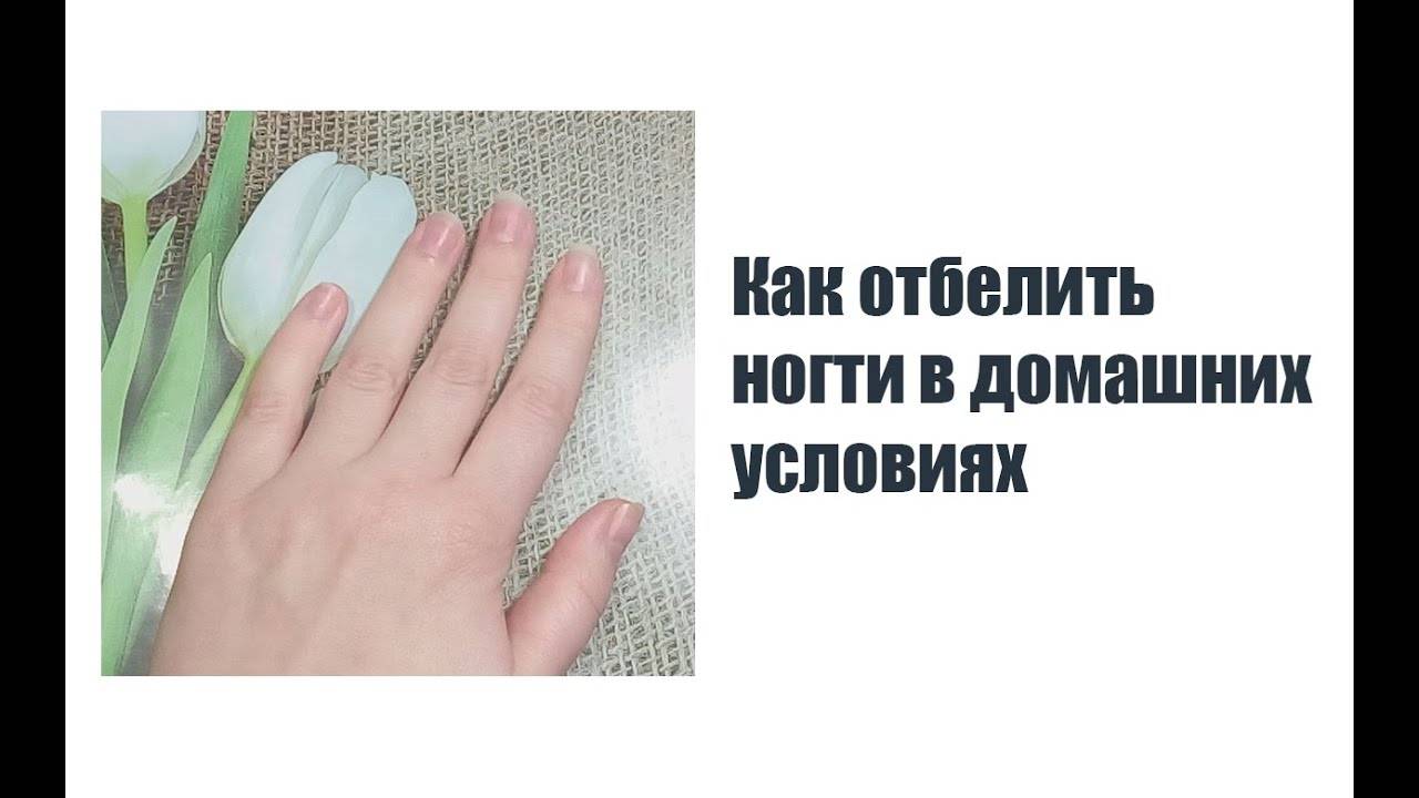 Как быстро отбелить ногти для маникюра в домашних условиях -