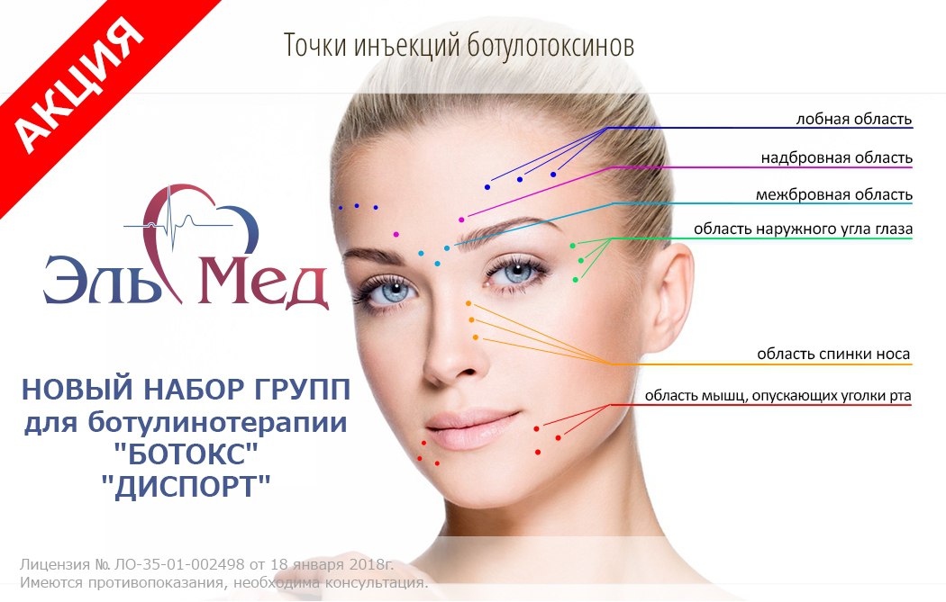 Подтяжка лба и бровей - фронтлифтинг и броулифтинг