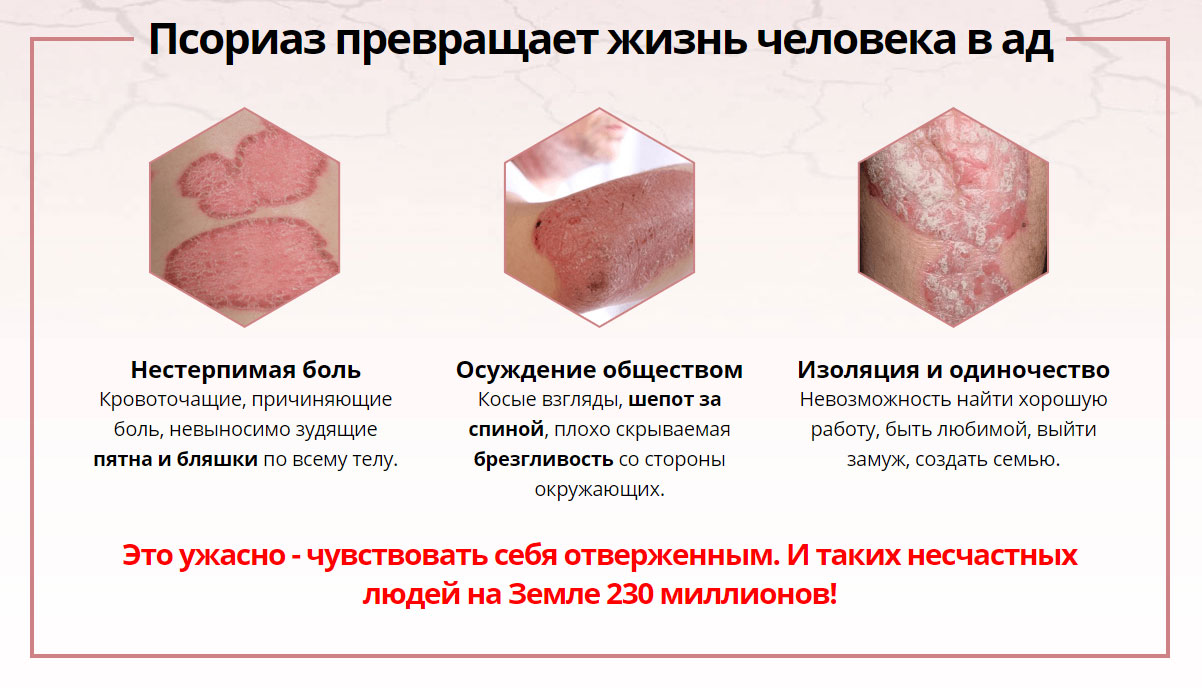 Дерматит на лице: 7 фото с описанием, лечение, причины, симптомы