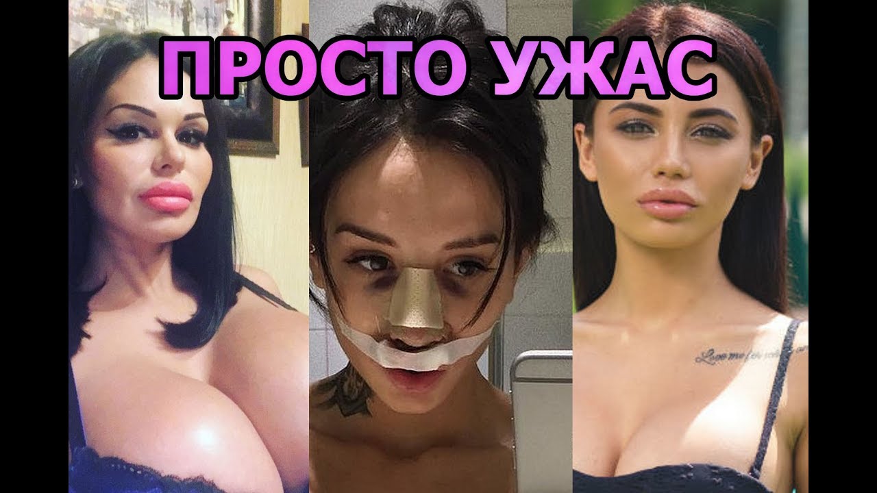 Кто по нации лиля из дома 2. лилия четрару: темная лошадка из молдавии. пластические операции лилии четрару