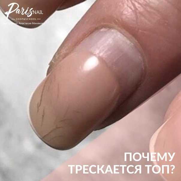 Почему трескается гель-лак на ногтях: от чего трещина через неделю, лопается матовый топ, как спасти, если треснул