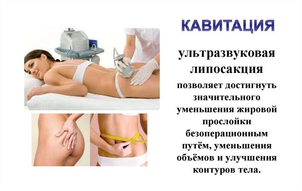 Кавитация - что это за процедура, поможет ли для похудения, как влияет на кожу — секреты красоток