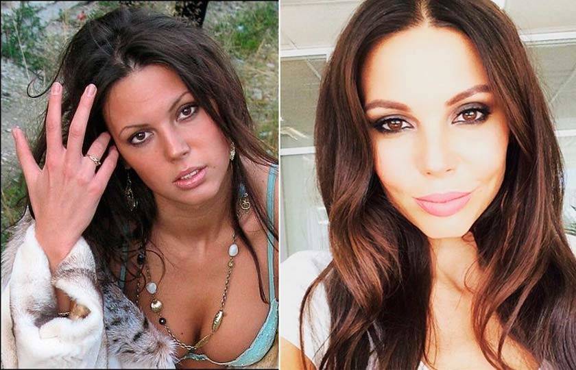 Оксана самойлова до и после пластических операций, фото и видео