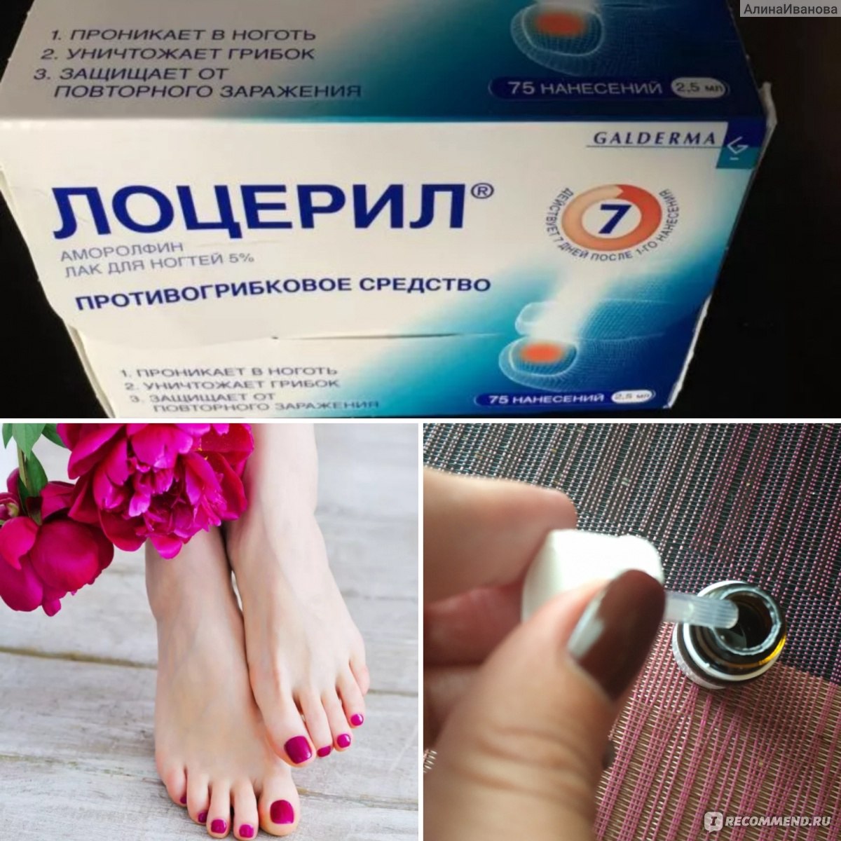 Рейтинг средств от грибка ногтей: топ 15 эффективных средств