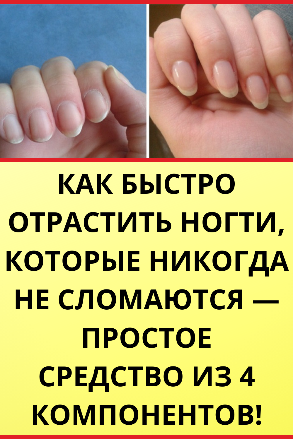 Как быстро отрастить ногти в домашних условиях: комплексный подход