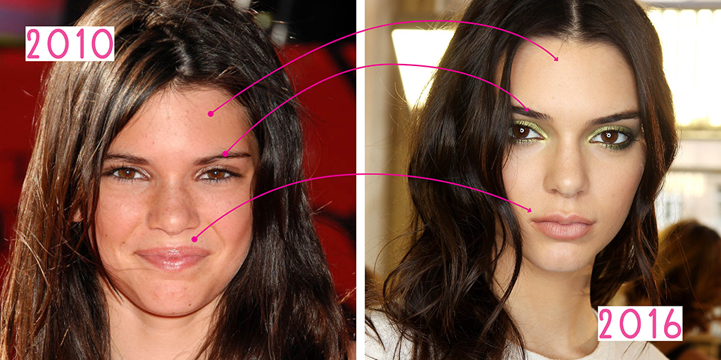 Has kendall jenner had plastic surgery?