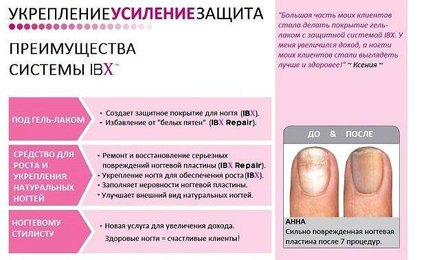 Гель-лак при беременности: можно ли делать шеллак на ногтях под лампой и красить ногти на ранних сроках