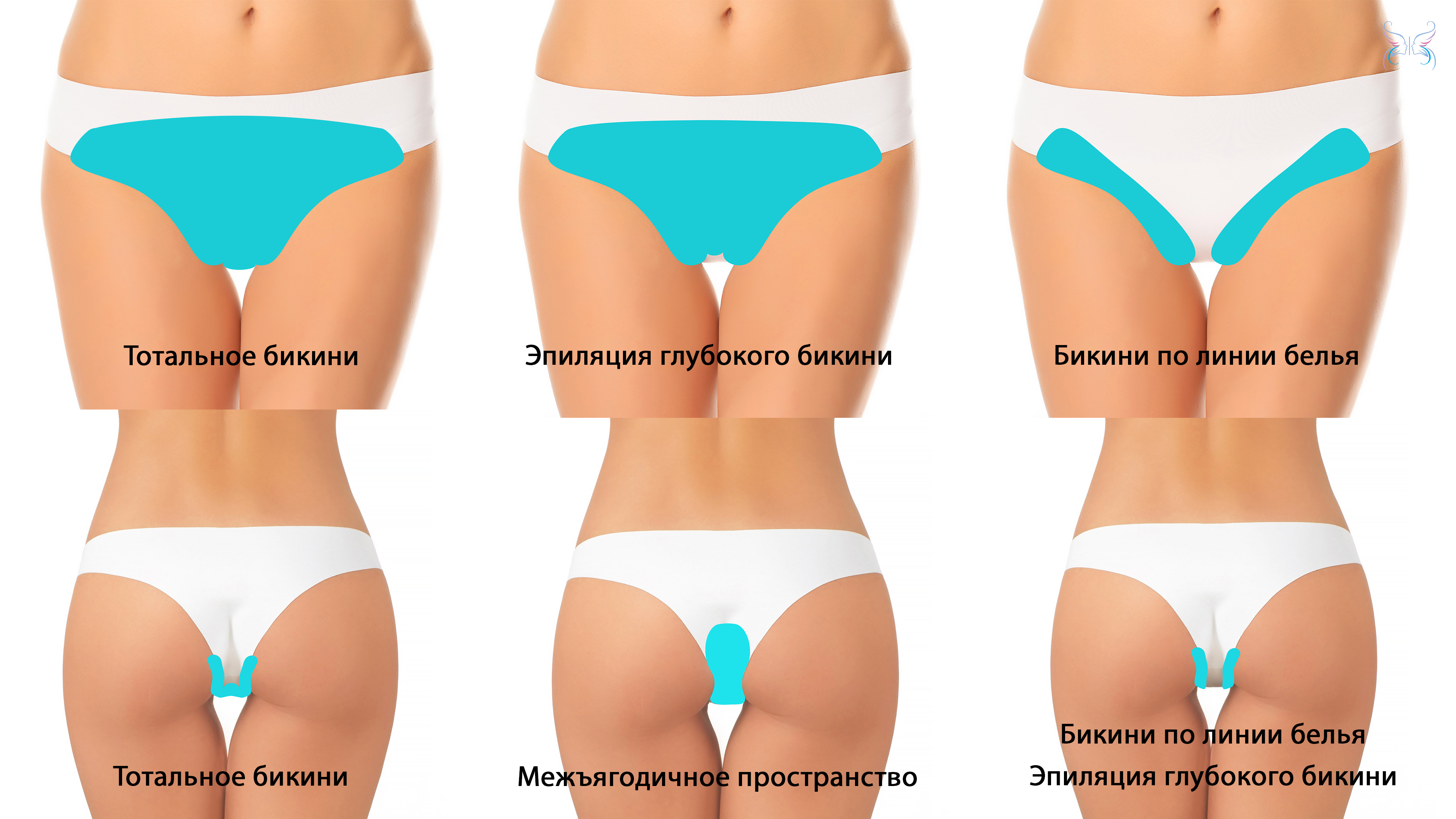 Как сделать интимную эпиляцию в домашних условиях?