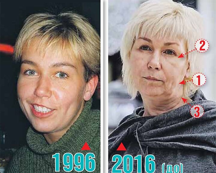 Ксения стриж пластика лица. ксения стриж до и после операции. детство и актерская деятельность