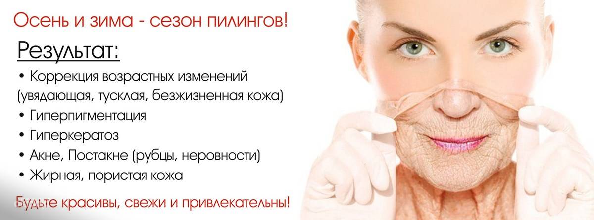 Все о химических пилингах: какие они бывают и какой эффект оказывают