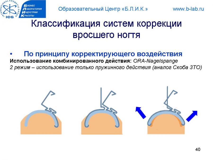 Коррекция вросшего ногтя: специальные способы исправления ногтевой пластины | mfarma.ru