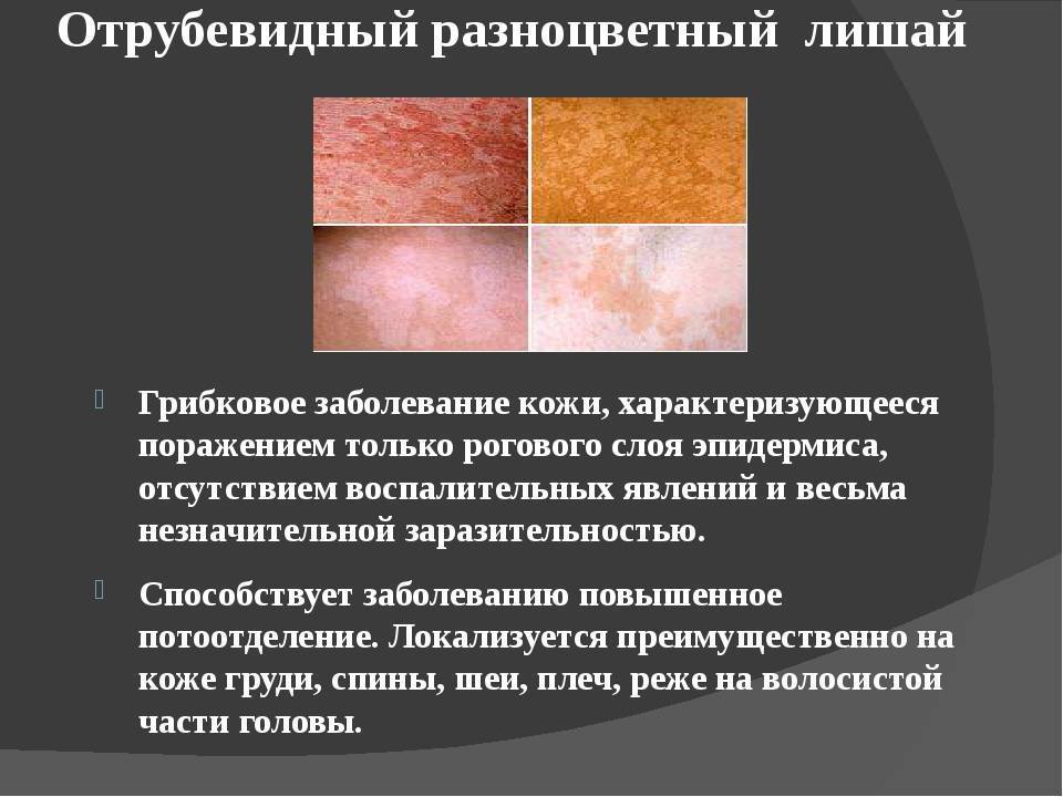 Нейродермит - причины, симптомы и лечение хронического кожного заболевания