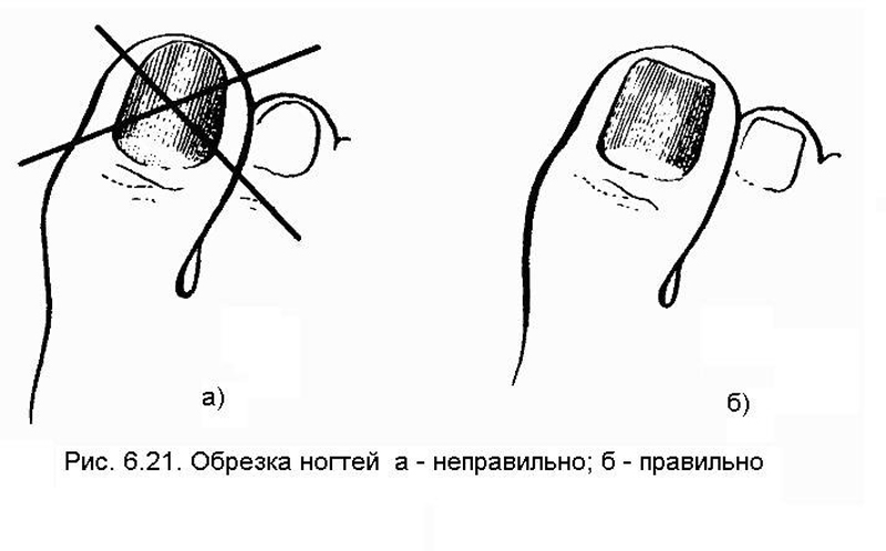 Как правильно стричь ногти на ногах: подготовка, пошаговая инструкция