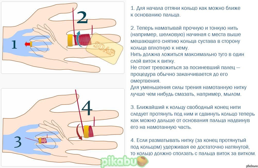 Удалось снять кольцо при помощи нитки - страна мам