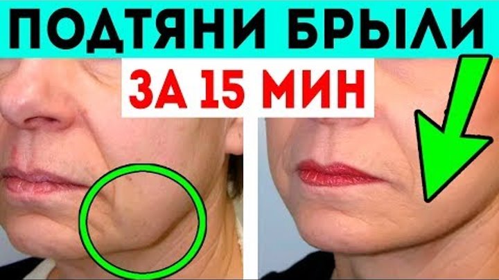 Брыли – причины появления и методы избавления +фото. как избавиться в домашних условиях и что это такое