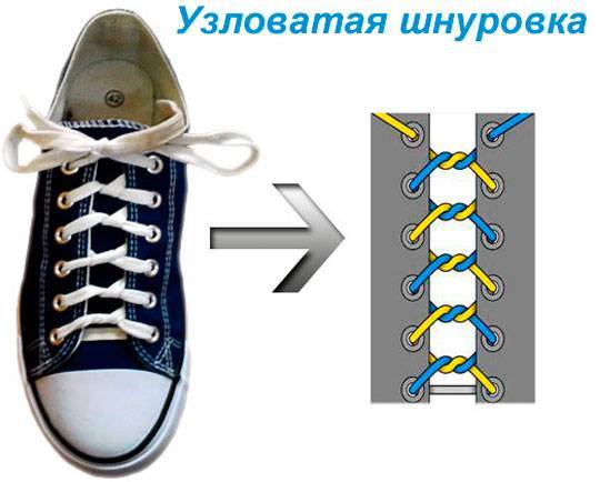 узловатая техника шнурования кед