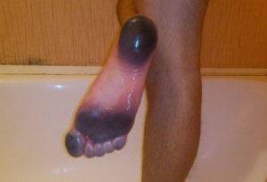 Что делать, если красятся туфли внутри