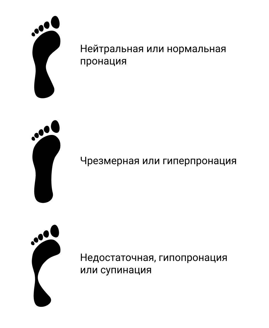 Что такое пронация в кроссовках
