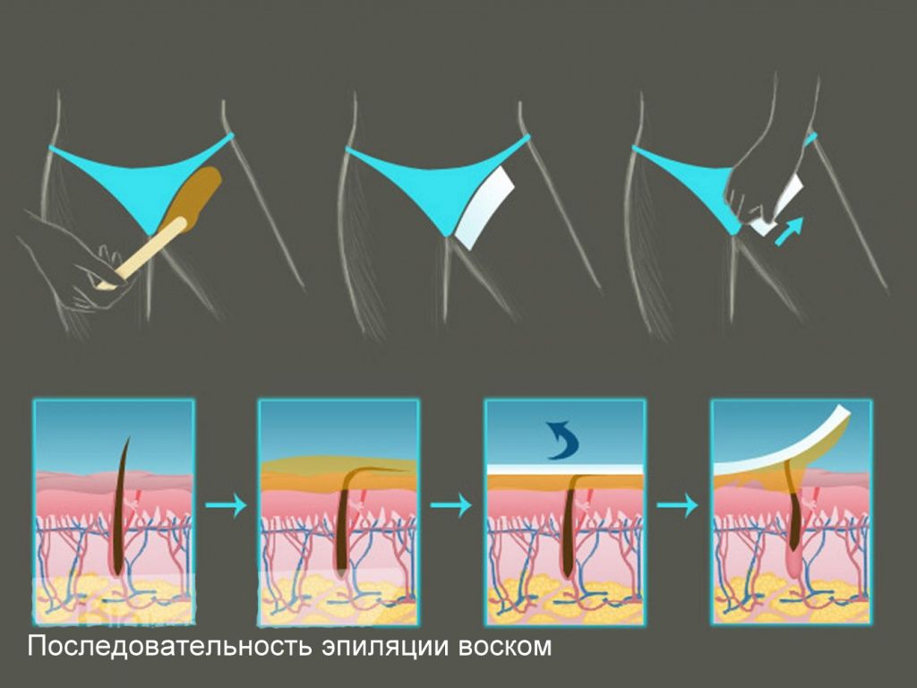 Эпиляция воском глубокое бикини: преимущества и недостатки