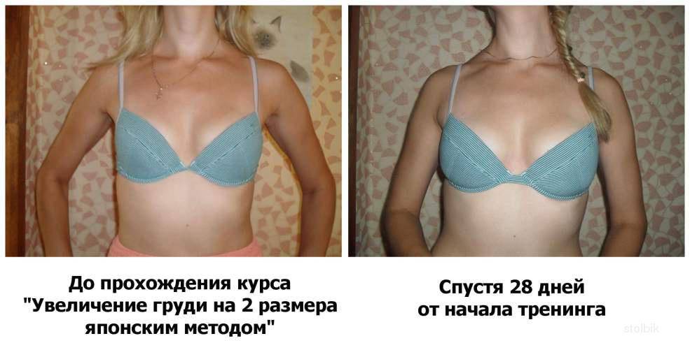 Помазала грудь йодом болит
