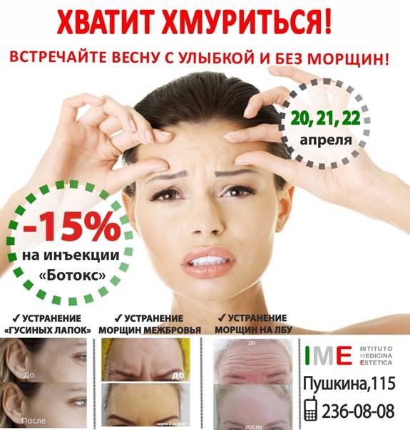 Как убрать морщины под глазами: способы косметологии | как избавиться от морщин вокруг глаз у косметолога