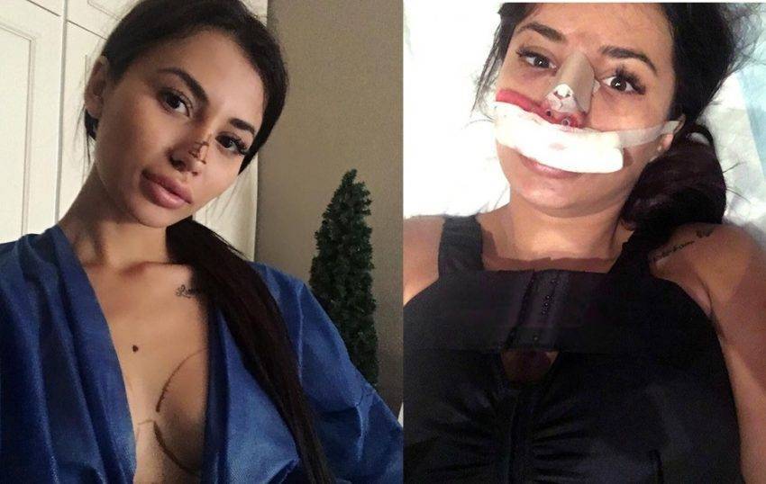 Что у лили с носом дом 2. лилия четрару: темная лошадка из молдавии