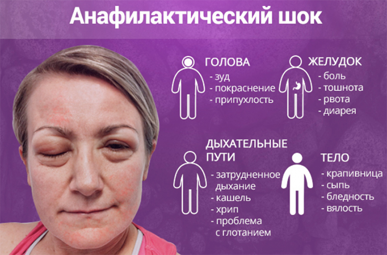 Почему горит лицо и сильно краснеет