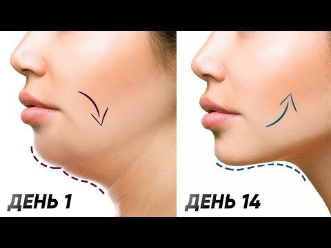 Появились брыли — что делать?