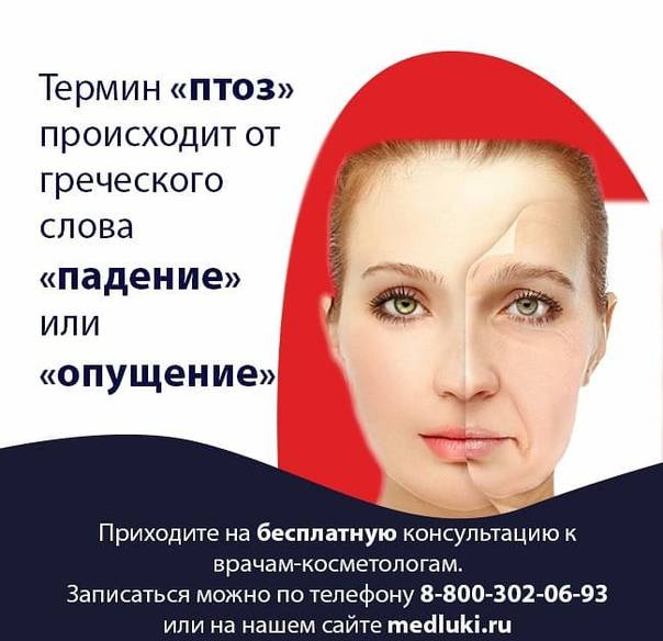 Гравитационный птоз - причины возникновения, как подтянуть овал лица