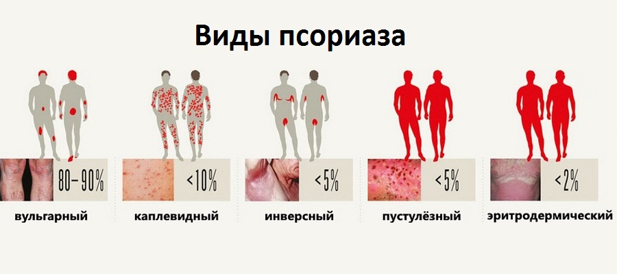 Заболевания кожи (лица, головы и других частей тела) у детей и взрослых – фото, названия и классификация, причины и симптомы, описание болезней кожи и методы их лечения