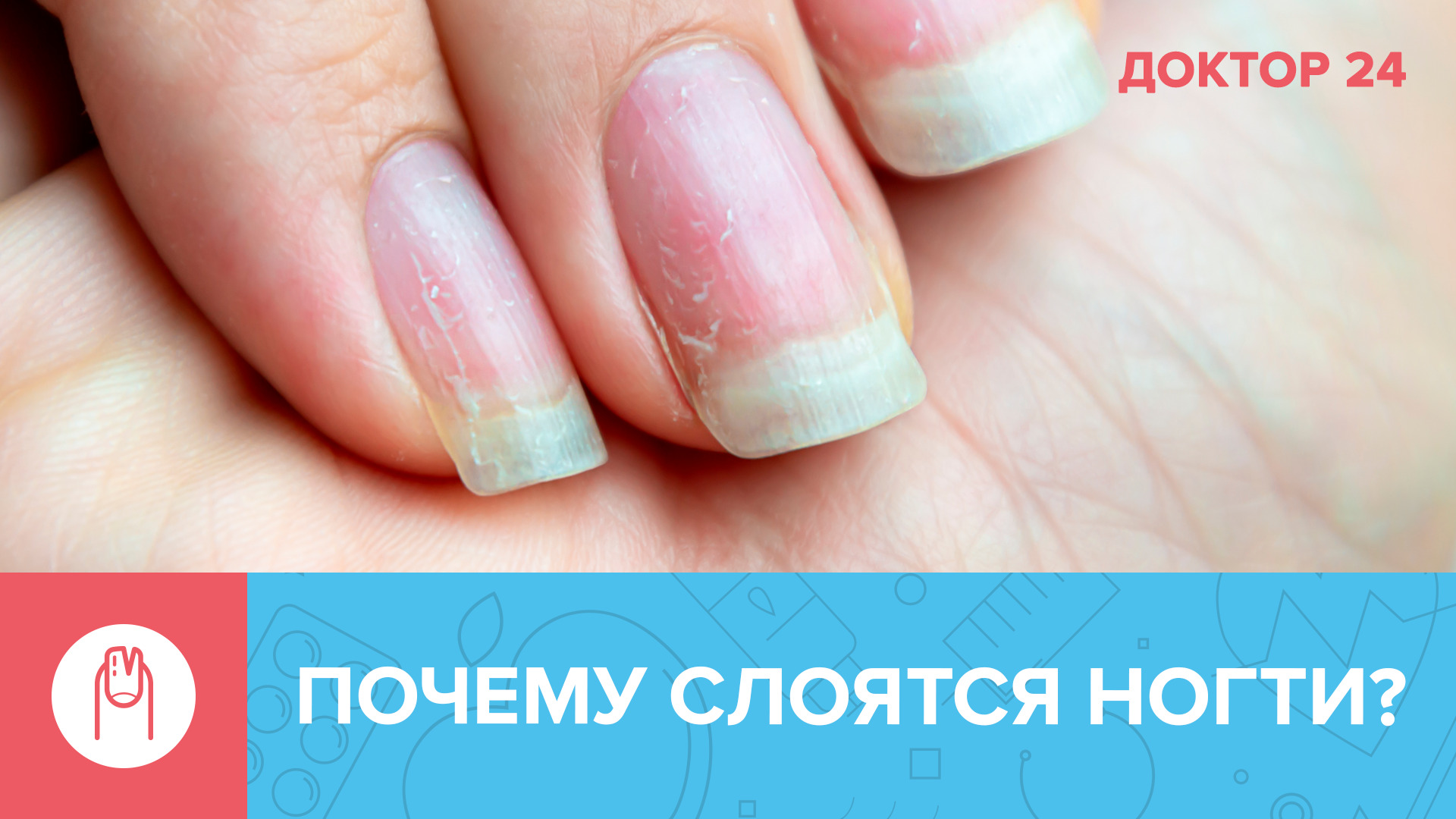 Слоятся ногти: причины и лечение