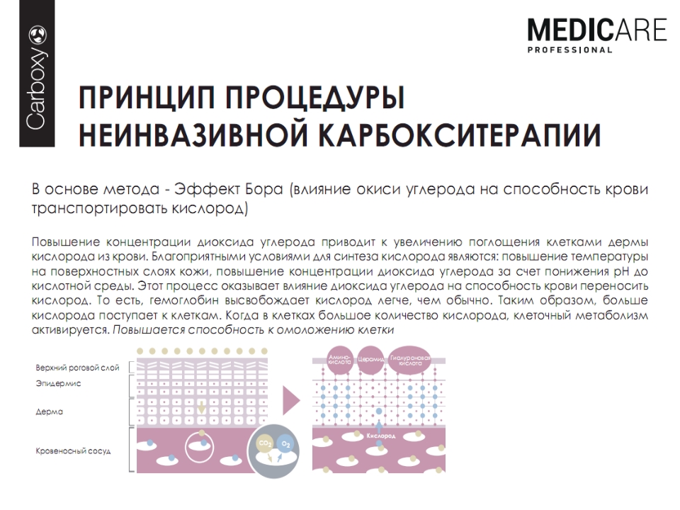 Карбокситерапия лица: стоит ли делать? эффект, последствия
